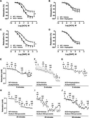 Haptoglobin treatment contributes to regulating nitric oxide signal and reduces oxidative stress in the penis: A preventive treatment for priapism in sickle cell disease